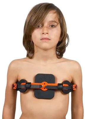 Medkaltec Wp953 pectus carinatum ortezi dinamik