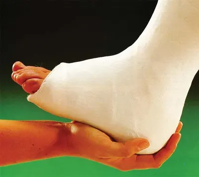 Medikalcim Alçılı Sargı Bezi 20 CM - Güvenilir ve Ergonomik